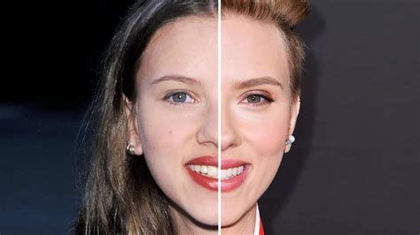 Scarlett Johansson Before And After Plastic Surgery 0