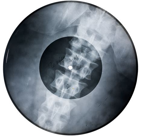 In Soviet Russia Forbidden Music Was Smuggled On X Ray Records Vice