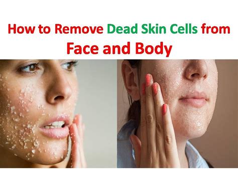Home Remedy For Dead Skin Cells How To Get Rid Of Dead