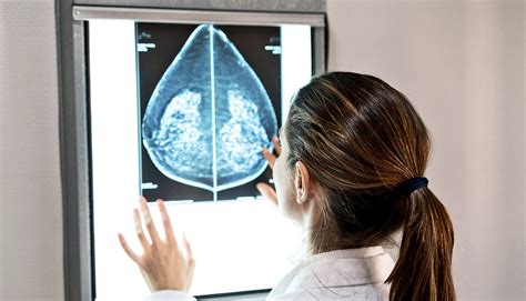 Ai Boosts Breast Cancer Detection Accuracy Futurity