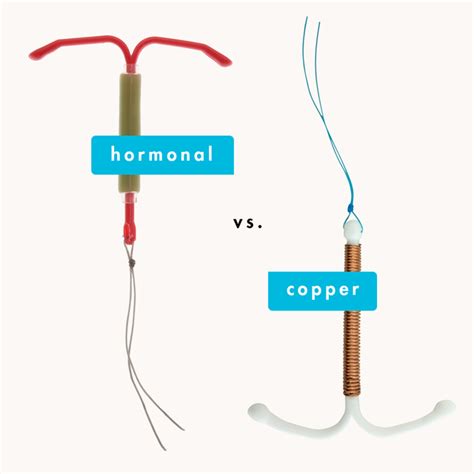 Copper Vs Hormonal Iuds — Know About Your Iud Options