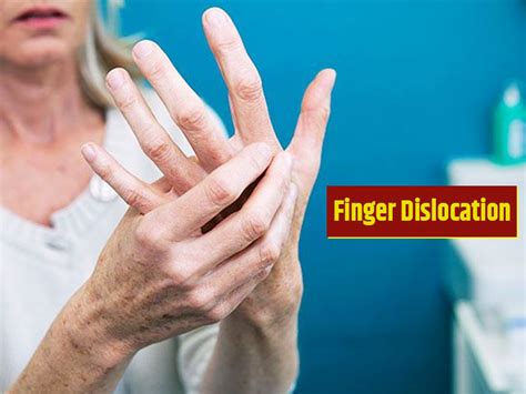 finger dislocation know symptoms causes diagnosis and ways to treat it