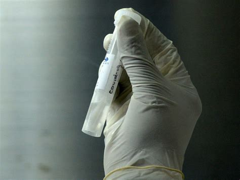 With the pcr tests we use, we can detect a possible corona infection a few days before a person is contagious to others. PCR-Test am Flughafen Wien: 70 Testungen am ersten Tag ...