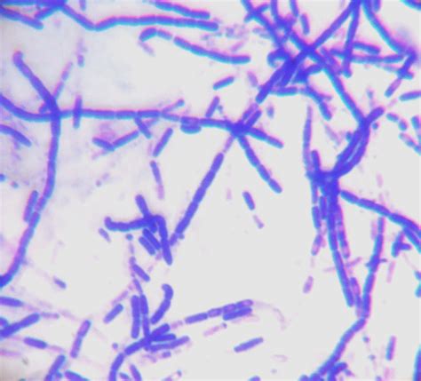 How Can I Identify These Three Types Of Gram Positive Bacilli Bacteria