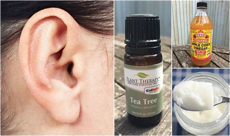 This is important because otherwise there can be dizziness. How To Get Rid Of Ear Wax: 6 Home Remedies That Really Work