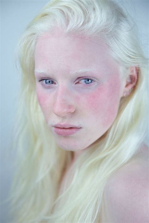 23 Fotos Que Muestran La Belleza De Personas Con Albinismo
