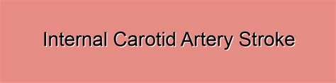 Internal Carotid Artery Stroke