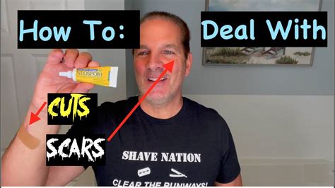 How To Deal With Cuts And Scars Youtube