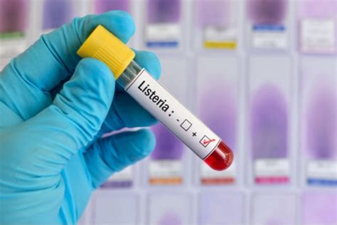 Listeria Outbreak Symptoms Signs And Treatment For Listeriosis