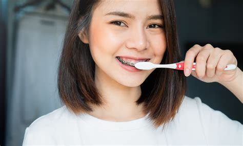 Taking Care Of Your Teeth While Wearing Braces In Singapore