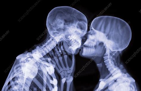Lovers Kissing X Ray Stock Image C0274422 Science Photo Library