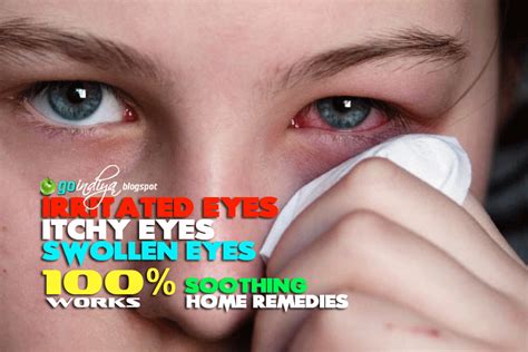 Red Itchy Eyes 25 Home Remedies For Soothing Itchy Swollen