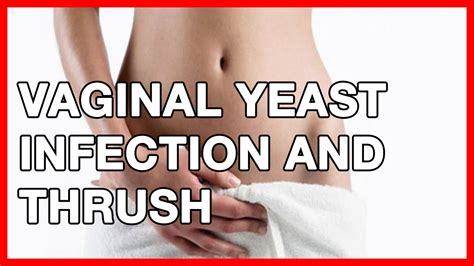vaginal yeast infection and thrush or candidiasis symptoms and signs youtube
