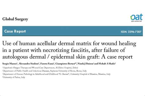 Use Of Human Acellular Dermal Matrix For Wound Healing In A Patient