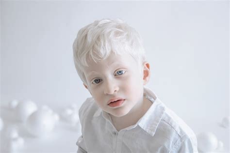 Albinism Photographs Yulia Taits Part 2 Popsugar Beauty