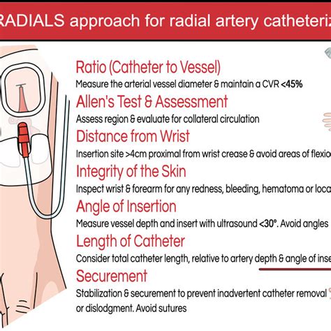 Pdf Preventing Radial Arterial Catheter Failure In Critical Care