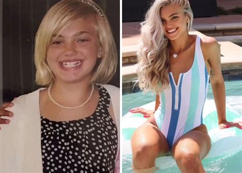 People Who Were Hit Hard By Puberty Share Their Glow Up Photos In Viral Tiktok Challenge