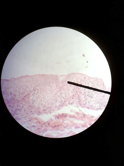 DUNIA BIOLOGIKU: JARINGAN EPITEL