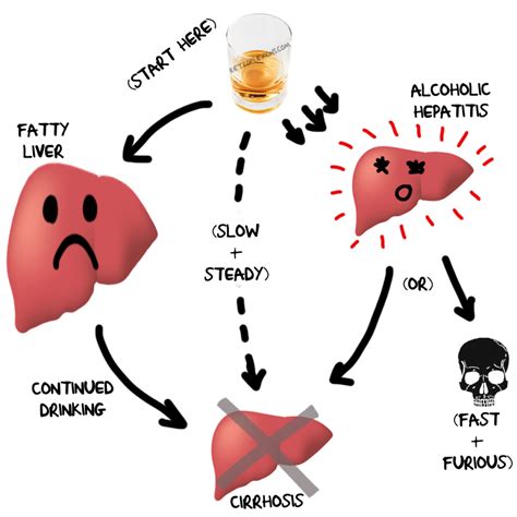 How Exactly Does Alcohol Cause Liver Problems