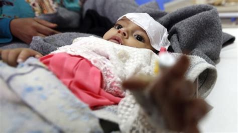 Yemen Cholera Cases Pass 300000 Mark Icrc Says Cbc News