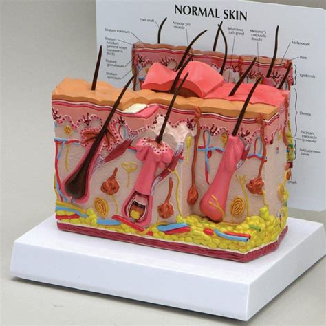 Skin Model With Acne Aceconcepts
