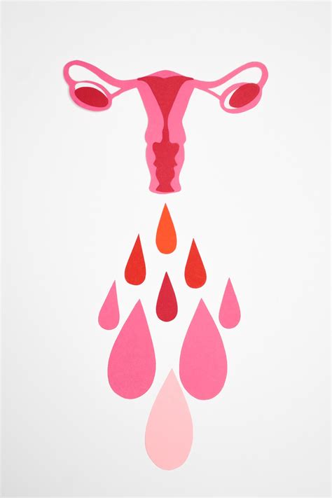 Sanguinamento Vaginale Fuori Dal Periodo Mestruale Le Maggiori Cause