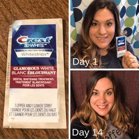 I Wore Crest Whitestrips For 14 Days And Heres What 49 Off