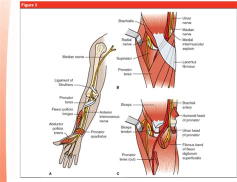 Figure 3 From Ulnar Tunnel Syndrome Radial Tunnel Syndrome Anterior