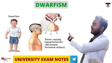 Pituitary Dwarfism Endocrine Physiology Youtube