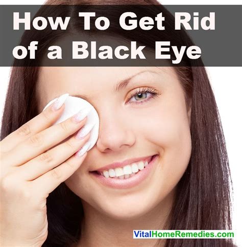 how to get rid of a black eye vital home remedies black eye remedies bruises remedy how to
