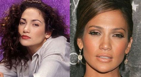 10 Celebrity Plastic Surgeries Gone Good Indiatoday