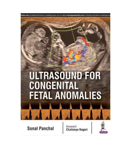 These fetuses usually have other associated cardiac anomalies. Ultrasound for Congenital Fetal Anomalies | SELLULAR