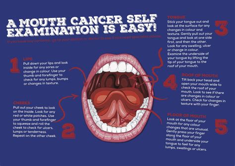 mouth cancer will murphy dentistry