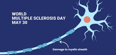 Multiple Sclerosis Research Strides So Far Happiest Health