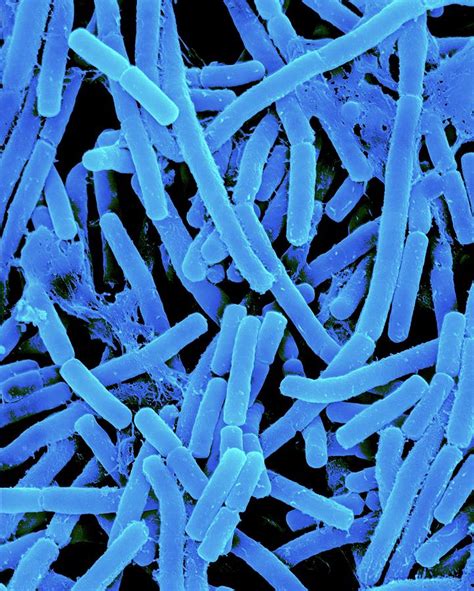 Propionibacterium Acnes Photograph By Dennis Kunkel Microscopyscience