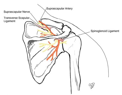 Cureus Persistent Shoulder Pain Due To A Suprascapular Nerve Injury