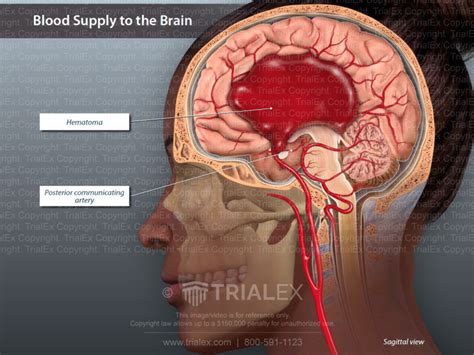 Blood Supply To The Brain Sagittal Cut Away View TrialExhibits Inc