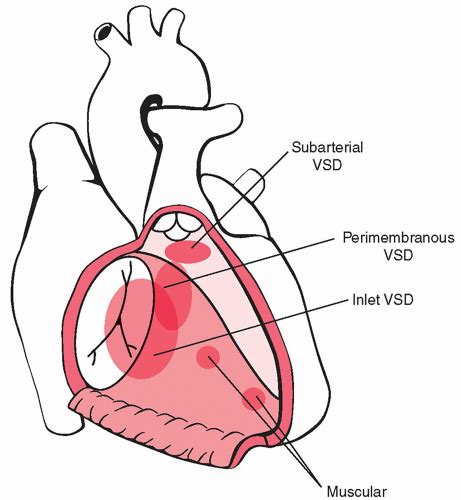 Heart Radiology Key