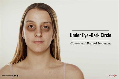 Dark Circles Under Eyes What Causes Dark Under Eye Circles And