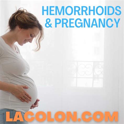 How To Treat Hemorrhoids During Pregnancy