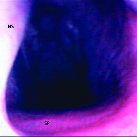 20 Endoscopic Image Of The Nasopharynx Of A Horse With A Cleft Palate