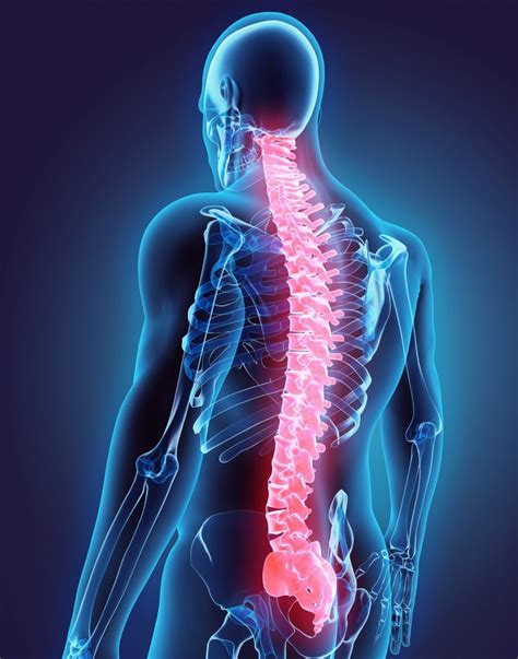 Spinal Cord Injuries What Workers Need To Know Wagner And Wagner