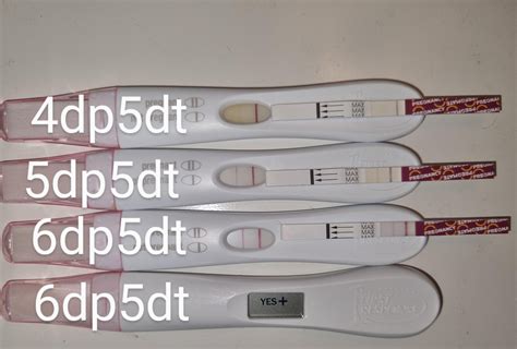 4dp5dt To 6dp5dt Progresion Frer And Pregmate Is The Progression