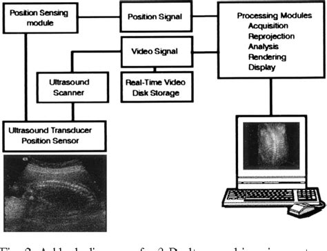Figure 2 From Three Dimensional Ultrasound Imaging Semantic Scholar