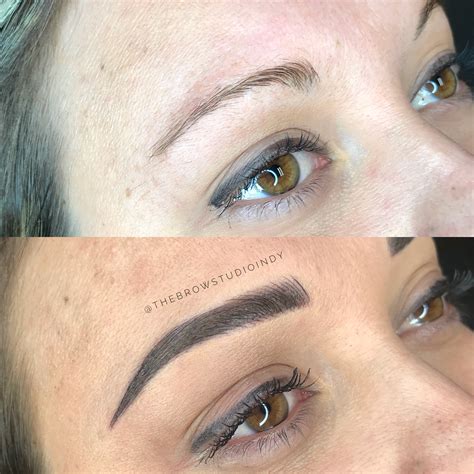 Before And After Combination Brow At Before And