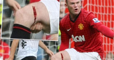 Wayne Rooney Hoping For Injury Return By The End Of The Month For England And Manchester United