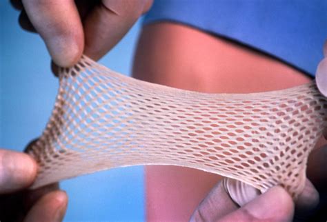 Vaginal Mesh Implants That Have Left Hundreds Of Women In Agonising Pain Should Be Banned Nice