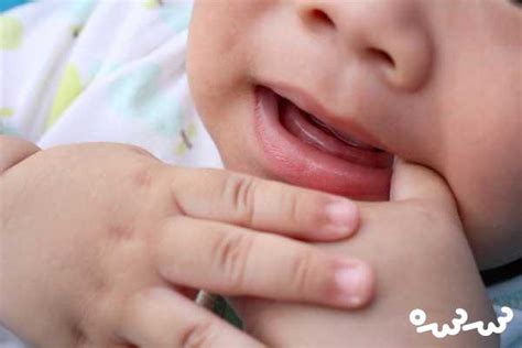 علائم دندان در آوردن نوزاد ؛ چه موقع نگران شویم؟ سرسره