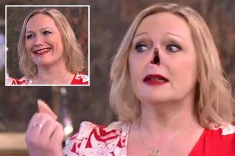 this morning fans in shock as woman suddenly pulls off her prosthetic nose without warning the