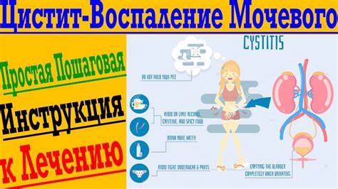 Воспаление почек диета Цистит – воспаление мочевого пузыря ! Простая инструкция к лечению Цистит – воспаление мочевого пузыря ! Простая инструкция к лечению Воспаление почек диета